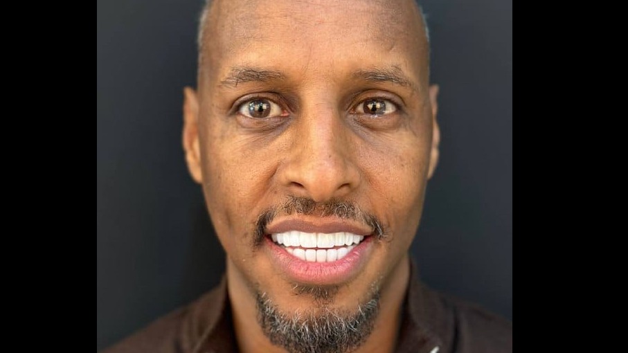 Full Implant Smile Makeover